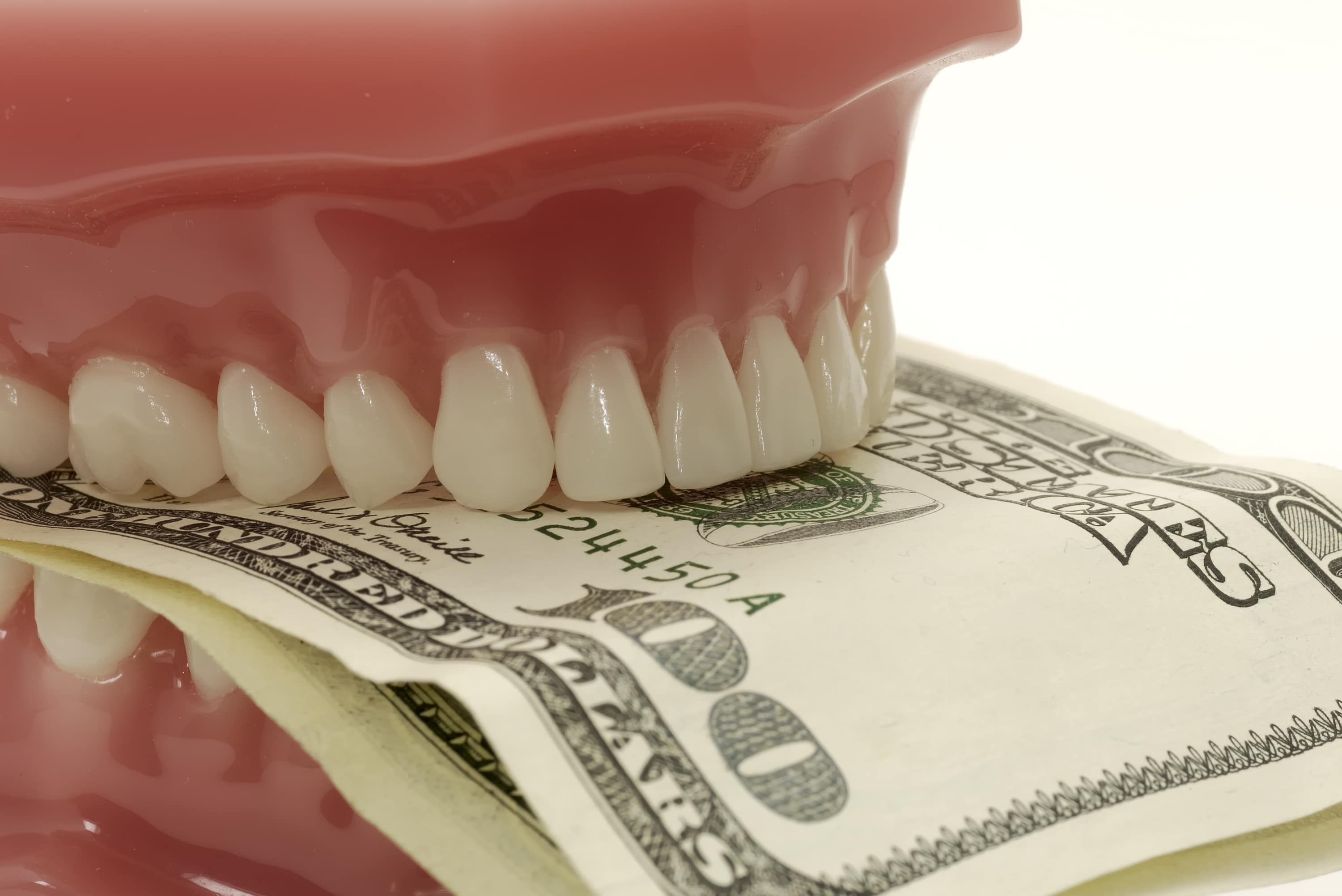 Is Dental Insurance Worth It? - Affordable Plans, Types ...